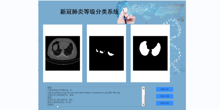 新冠肺炎分类＆分割算法全家桶（源码＆教程）